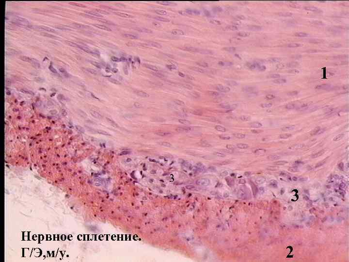 1 3 3 Нервное сплетение. Г/Э, м/у. 2 