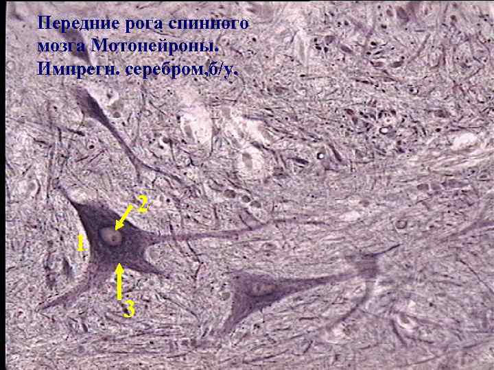 Передние рога спинного мозга Мотонейроны. Импрегн. серебром, б/у. 2 1 3 