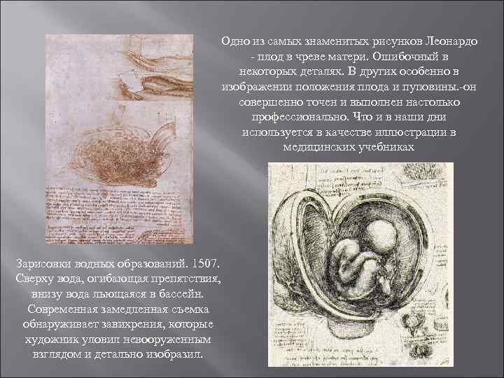 Одно из самых знаменитых рисунков Леонардо - плод в чреве матери. Ошибочный в некоторых