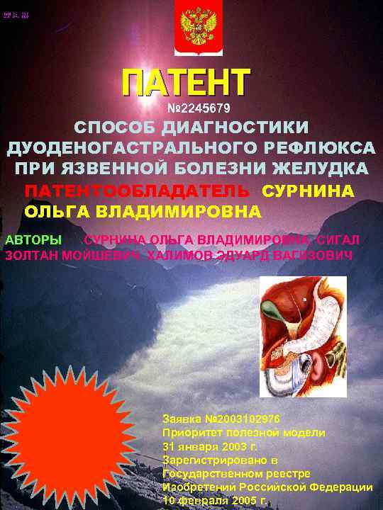 ПАТЕНТ № 2245679 СПОСОБ ДИАГНОСТИКИ ДУОДЕНОГАСТРАЛЬНОГО РЕФЛЮКСА ПРИ ЯЗВЕННОЙ БОЛЕЗНИ ЖЕЛУДКА ПАТЕНТООБЛАДАТЕЛЬ СУРНИНА ОЛЬГА