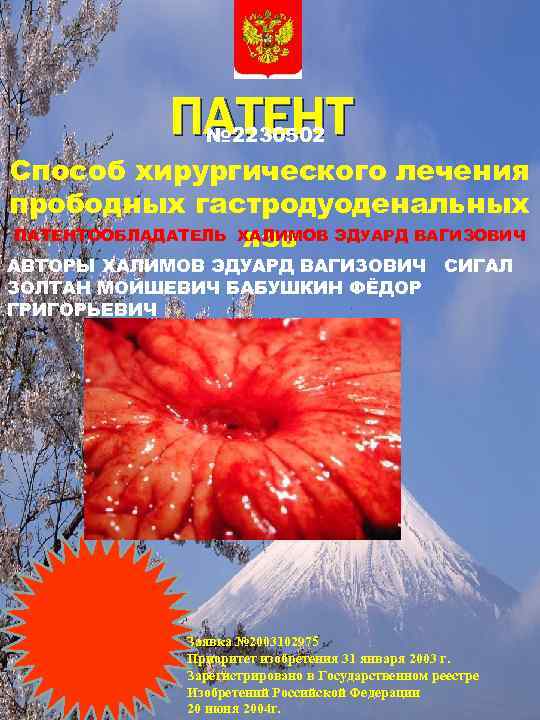 ПАТЕНТ № 2230502 Способ хирургического лечения прободных гастродуоденальных ПАТЕНТООБЛАДАТЕЛЬ ХАЛИМОВ ЭДУАРД ВАГИЗОВИЧ язв АВТОРЫ