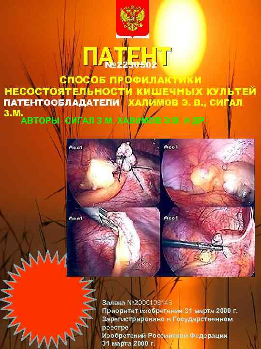 ПАТЕНТ № 2230502 СПОСОБ ПРОФИЛАКТИКИ НЕСОСТОЯТЕЛЬНОСТИ КИШЕЧНЫХ КУЛЬТЕЙ ПАТЕНТООБЛАДАТЕЛИ ХАЛИМОВ Э. В. , СИГАЛ