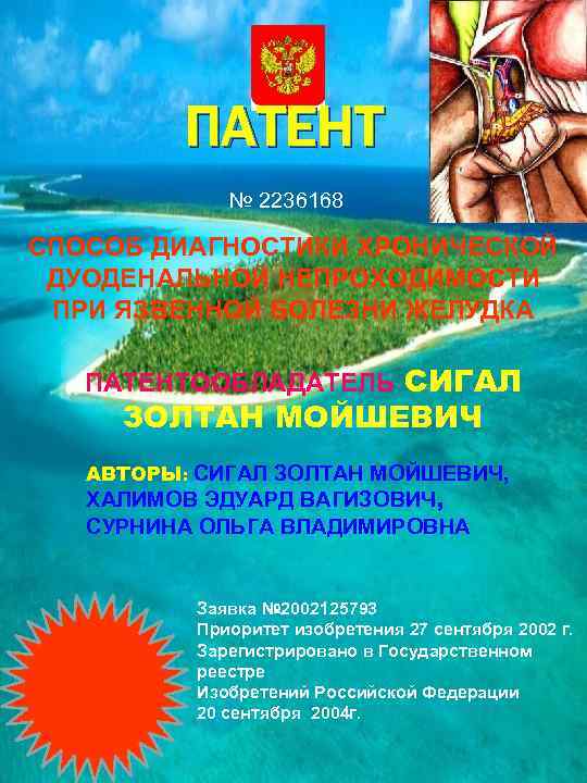 ПАТЕНТ № 2236168 СПОСОБ ДИАГНОСТИКИ ХРОНИЧЕСКОЙ ДУОДЕНАЛЬНОЙ НЕПРОХОДИМОСТИ ПРИ ЯЗВЕННОЙ БОЛЕЗНИ ЖЕЛУДКА ПАТЕНТООБЛАДАТЕЛЬ СИГАЛ