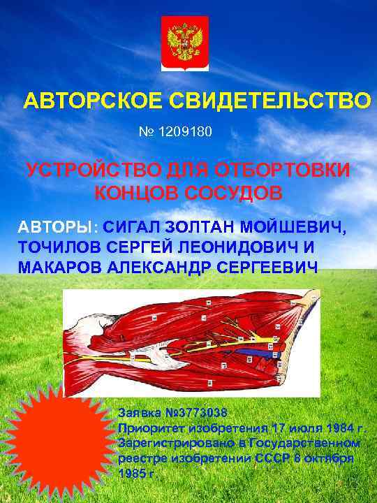 АВТОРСКОЕ СВИДЕТЕЛЬСТВО № 1209180 УСТРОЙСТВО ДЛЯ ОТБОРТОВКИ КОНЦОВ СОСУДОВ АВТОРЫ: СИГАЛ ЗОЛТАН МОЙШЕВИЧ, ТОЧИЛОВ