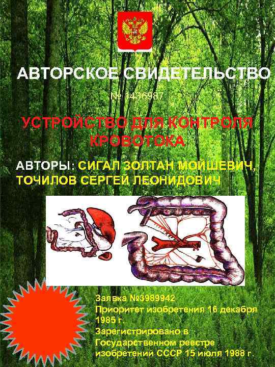 АВТОРСКОЕ СВИДЕТЕЛЬСТВО № 1436987 УСТРОЙСТВО ДЛЯ КОНТРОЛЯ КРОВОТОКА АВТОРЫ: СИГАЛ ЗОЛТАН МОЙШЕВИЧ, ТОЧИЛОВ СЕРГЕЙ