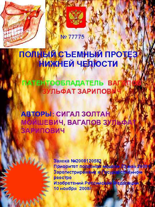 № 77775 ПОЛНЫЙ СЪЕМНЫЙ ПРОТЕЗ НИЖНЕЙ ЧЕЛЮСТИ ПАТЕНТООБЛАДАТЕЛЬ ВАГАПОВ ЗУЛЬФАТ ЗАРИПОВИЧ АВТОРЫ: СИГАЛ ЗОЛТАН