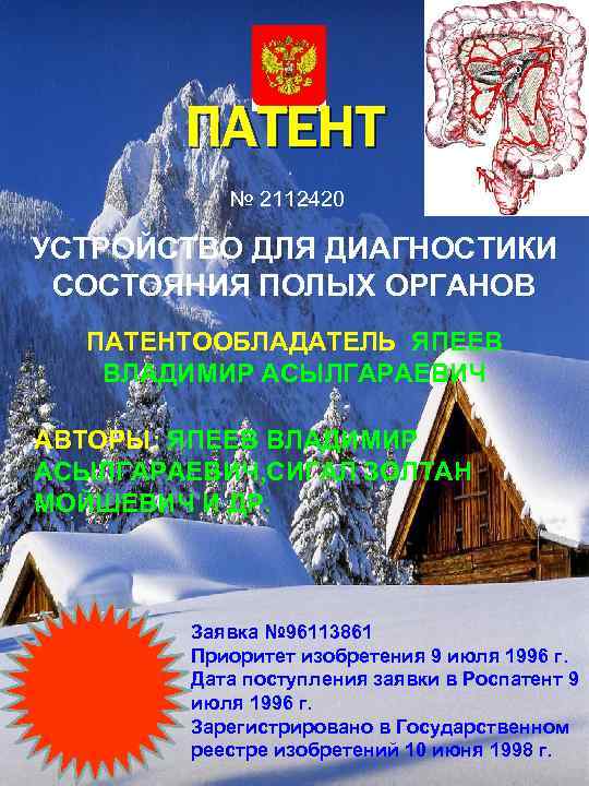 ПАТЕНТ № 2112420 УСТРОЙСТВО ДЛЯ ДИАГНОСТИКИ СОСТОЯНИЯ ПОЛЫХ ОРГАНОВ ПАТЕНТООБЛАДАТЕЛЬ ЯПЕЕВ ВЛАДИМИР АСЫЛГАРАЕВИЧ АВТОРЫ: