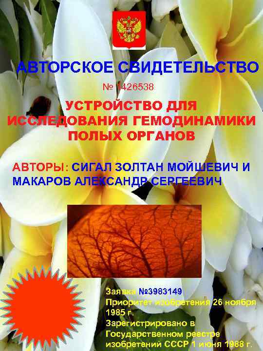 АВТОРСКОЕ СВИДЕТЕЛЬСТВО № 1426538 УСТРОЙСТВО ДЛЯ ИССЛЕДОВАНИЯ ГЕМОДИНАМИКИ ПОЛЫХ ОРГАНОВ АВТОРЫ: СИГАЛ ЗОЛТАН МОЙШЕВИЧ