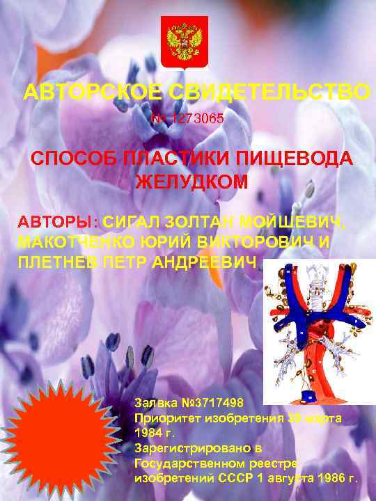 АВТОРСКОЕ СВИДЕТЕЛЬСТВО № 1273065 СПОСОБ ПЛАСТИКИ ПИЩЕВОДА ЖЕЛУДКОМ АВТОРЫ: СИГАЛ ЗОЛТАН МОЙШЕВИЧ, МАКОТЧЕНКО ЮРИЙ