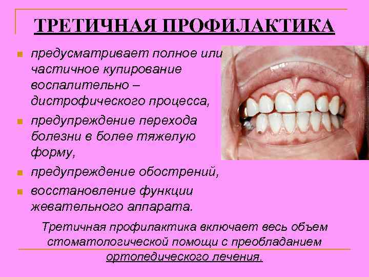 ТРЕТИЧНАЯ ПРОФИЛАКТИКА n n предусматривает полное или частичное купирование воспалительно – дистрофического процесса, предупреждение