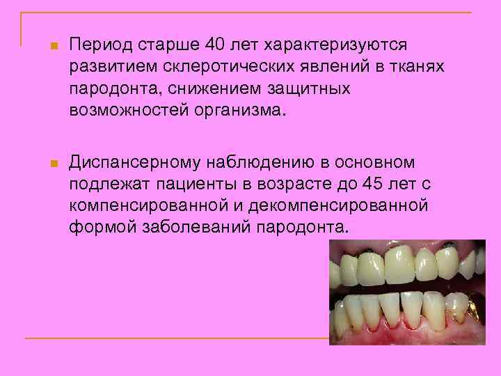 n Период старше 40 лет характеризуются развитием склеротических явлений в тканях пародонта, снижением защитных