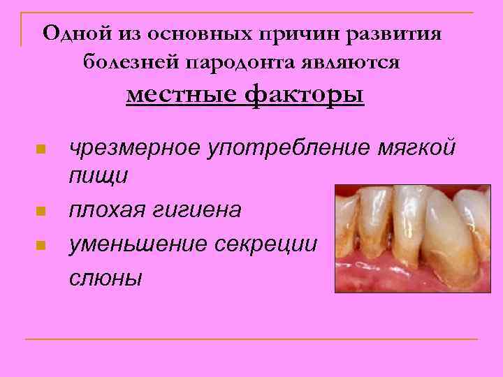 Одной из основных причин развития болезней пародонта являются местные факторы n n n чрезмерное
