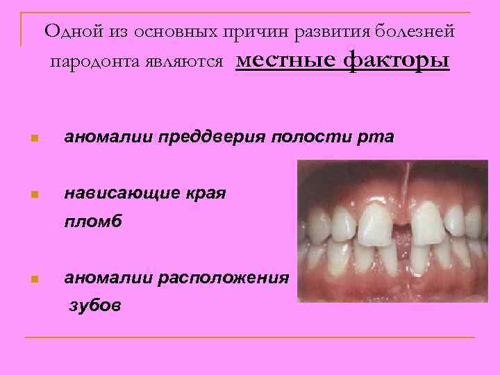 Одной из основных причин развития болезней пародонта являются местные факторы n аномалии преддверия полости