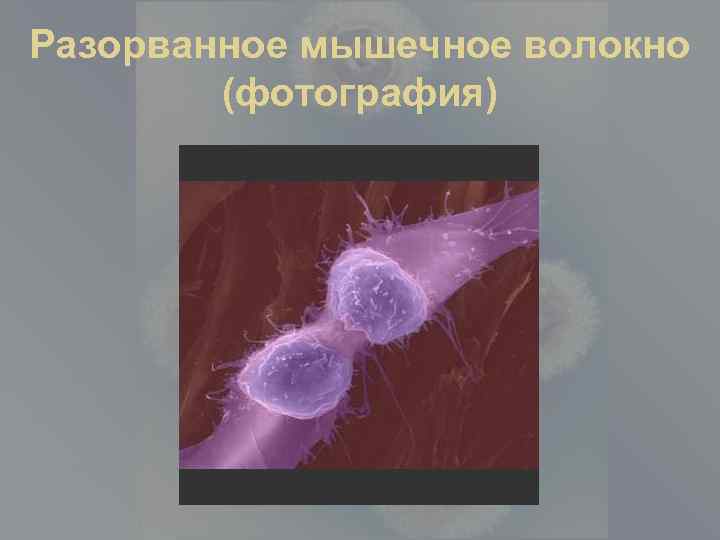 Разорванное мышечное волокно (фотография) 