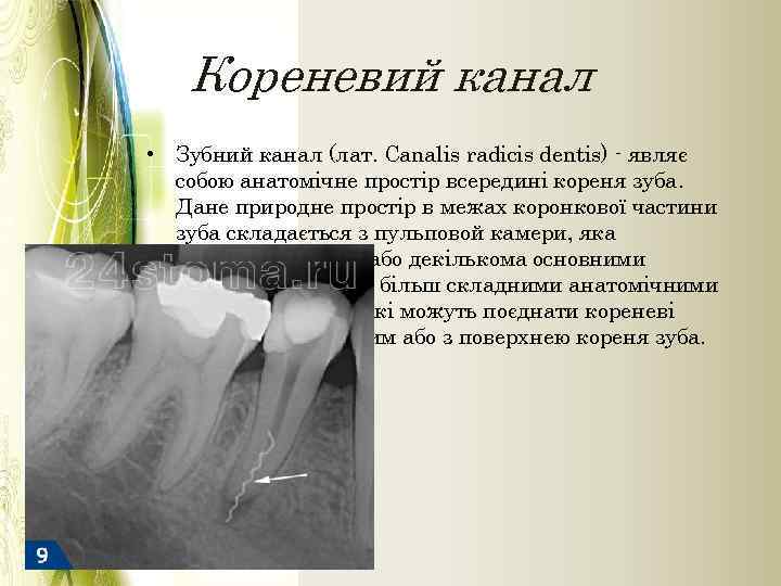 Кореневий канал • Зубний канал (лат. Canalis radicis dentis) - являє собою анатомічне простір