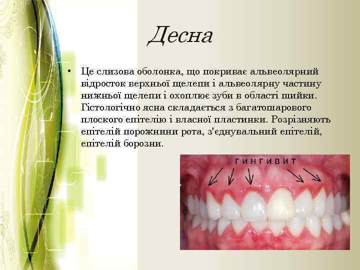 Десна • Це слизова оболонка, що покриває альвеолярний відросток верхньої щелепи і альвеолярну частину