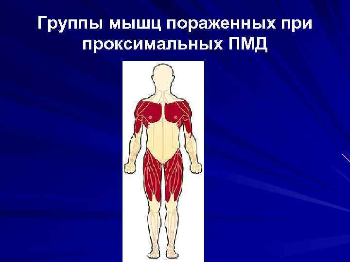 Группы мышц пораженных при проксимальных ПМД 