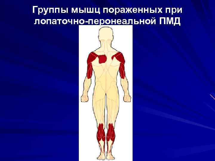 Мышечные аномалии. Наследственные мышечные заболевания. Наследственные заболевания нервно мышечной системы. Перонеальная группа мышц.