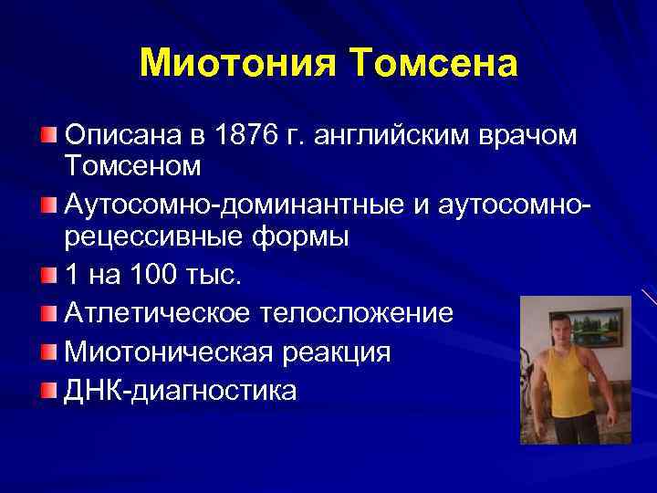 Миотоническая дистрофия презентация