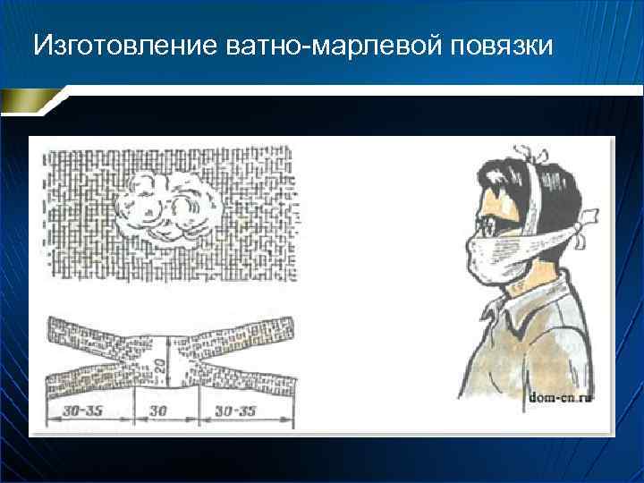 Изготовление ватно-марлевой повязки 