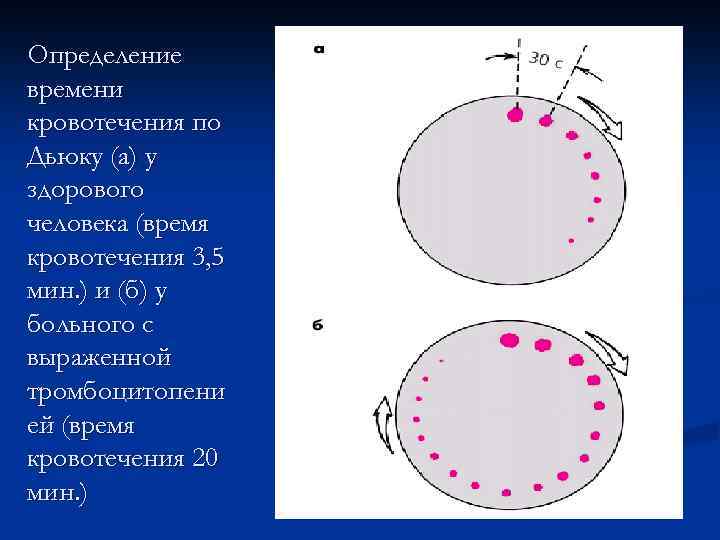 Время выявления. Длительность кровотечения по Дуке норма. Длительность кровотечения по Дьюку норма. Методика определения длительности кровотечения. Длительность кровотечения по Дюке, метод, нормативы у детей..