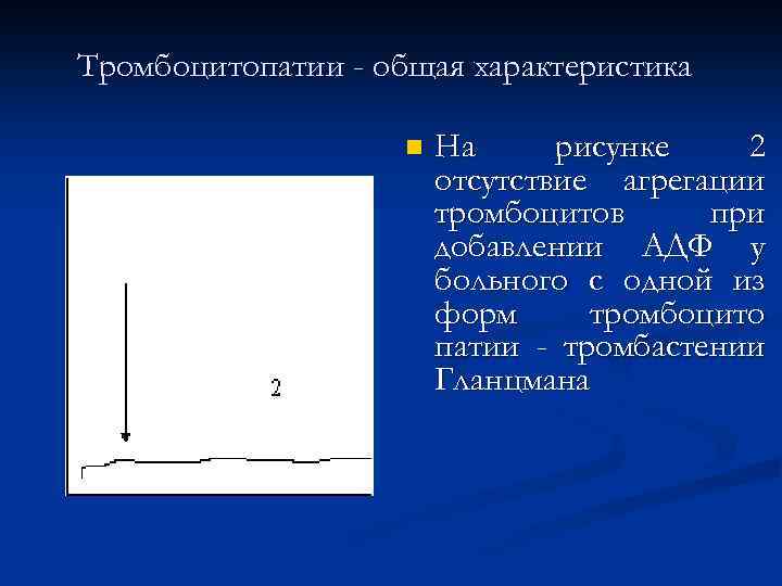 Тромбоцитопатии - общая характеристика n На рисунке 2 отсутствие агрегации тромбоцитов при добавлении АДФ