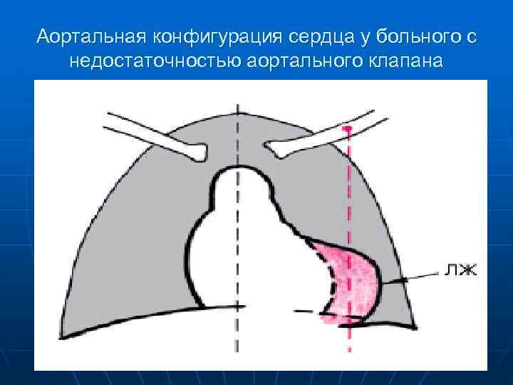 Конфигурация сердца