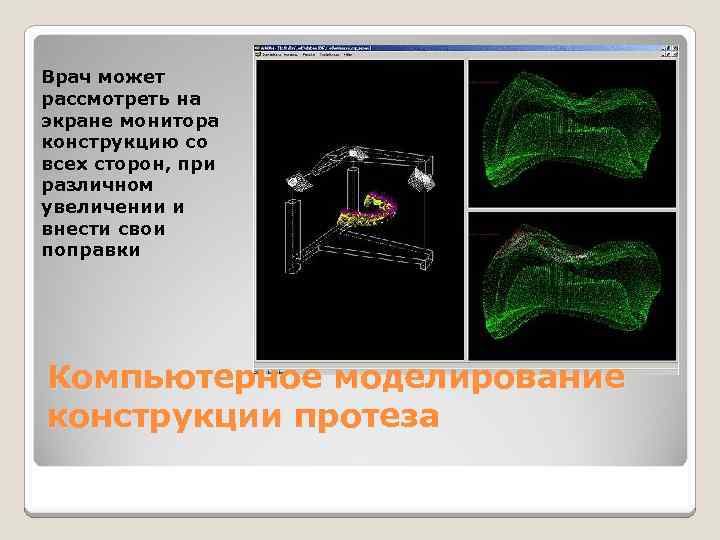 Что такое оптическое исследование сетчатки с помощью компьютерного анализатора