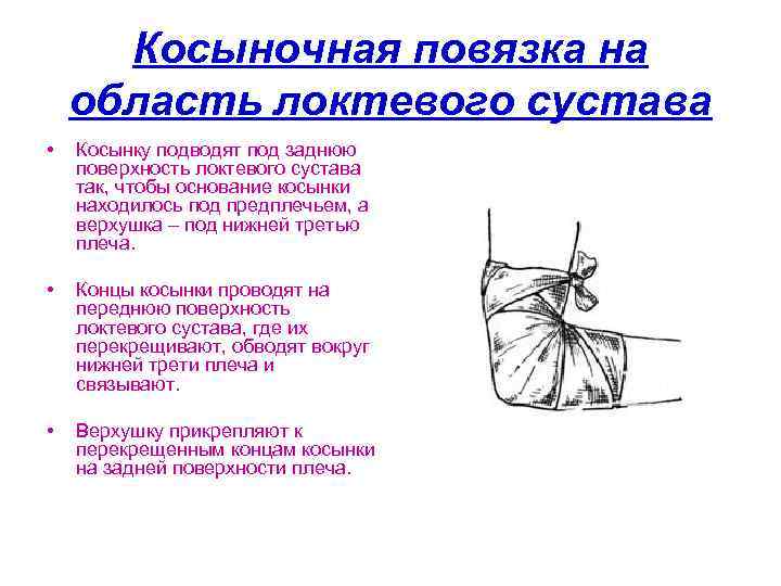 Перевязка косынка. Косыночная повязка на локтевой сустав алгоритм. Косыночная повязка на область локтевого сустава. Косыночная повязка алгоритм наложения. Алгоритм наложения косыночной повязки на локоть.