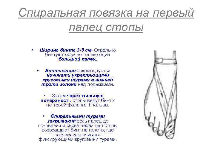 Спиральная повязка на первый палец стопы • Ширина бинта 3 -5 см. Отдельно бинтуют