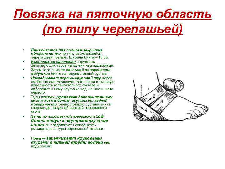 Повязка на пяточную область (по типу черепашьей) • • • Применяется для полного закрытия