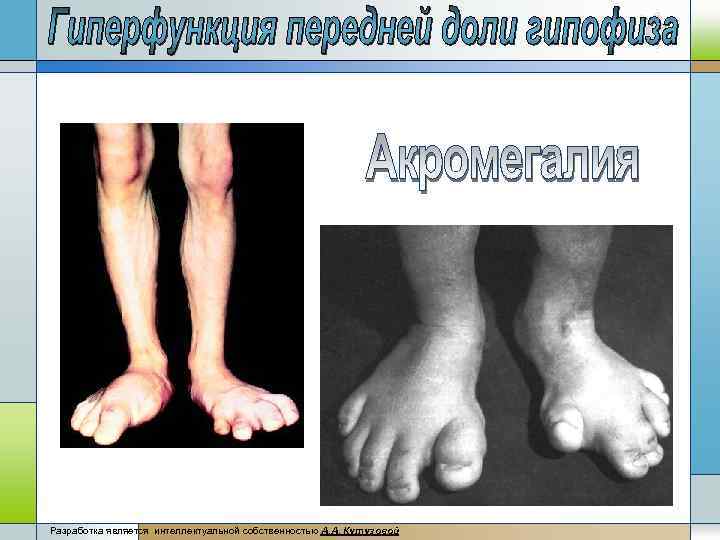 Разработка является интеллектуальной собственностью А. А, Кутузовой 