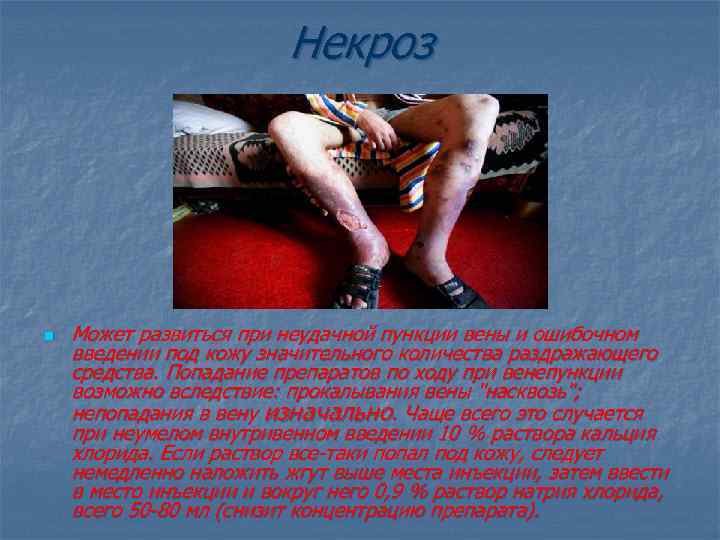 Некроз n Может развиться при неудачной пункции вены и ошибочном введении под кожу значительного