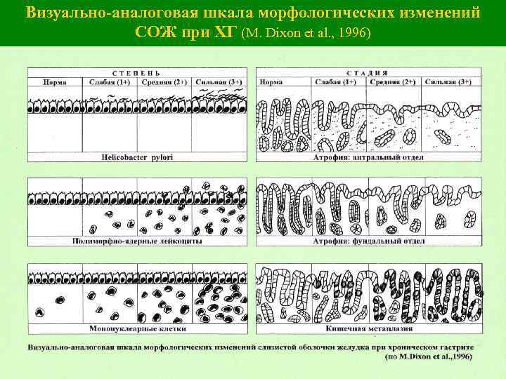 Визуально-аналоговая шкала морфологических изменений СОЖ при ХГ (M. Dixon et al. , 1996) 