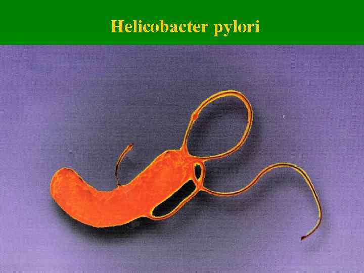 Helicobacter pylori 