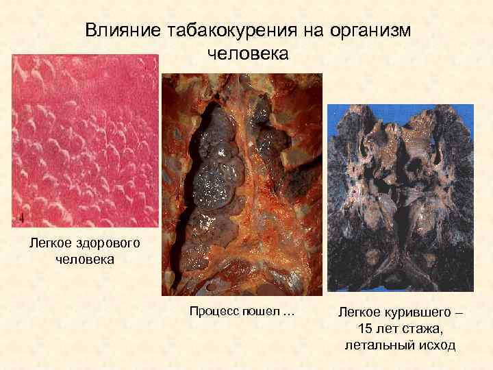 Влияние табакокурения на организм человека Легкое здорового человека Процесс пошел … Легкое курившего –