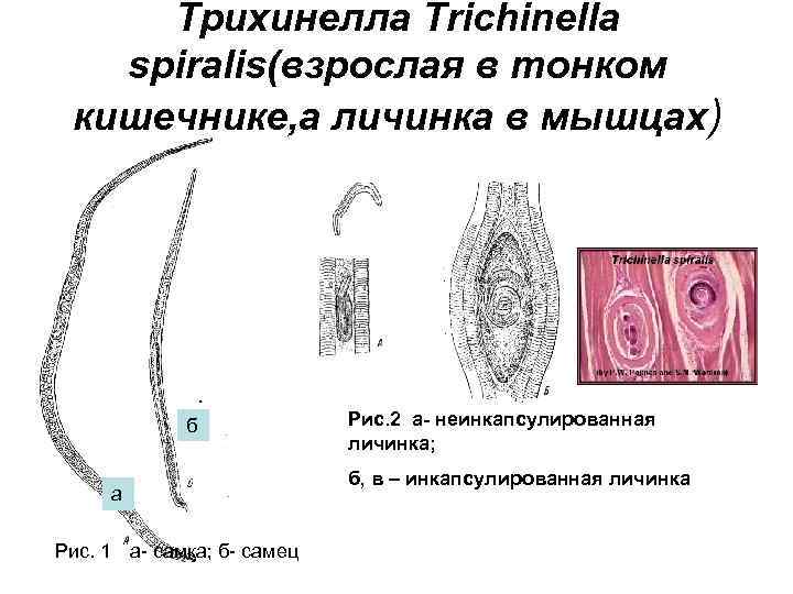 Личинки трихинеллы. Трихинелла Спиралис морфология. Трихинелла половозрелая особь. Инкапсулированная личинка трихинеллы. Трихинелла Спиралис личинки.