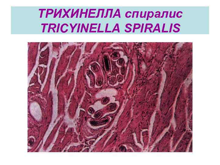 ТРИХИНЕЛЛА спиралис TRICYINELLA SPIRALIS 