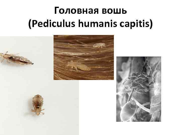 Головная вошь (Рediculus humanis capitis) 