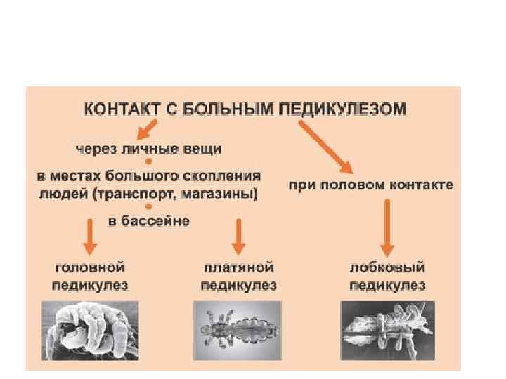 Заражение педикулезом