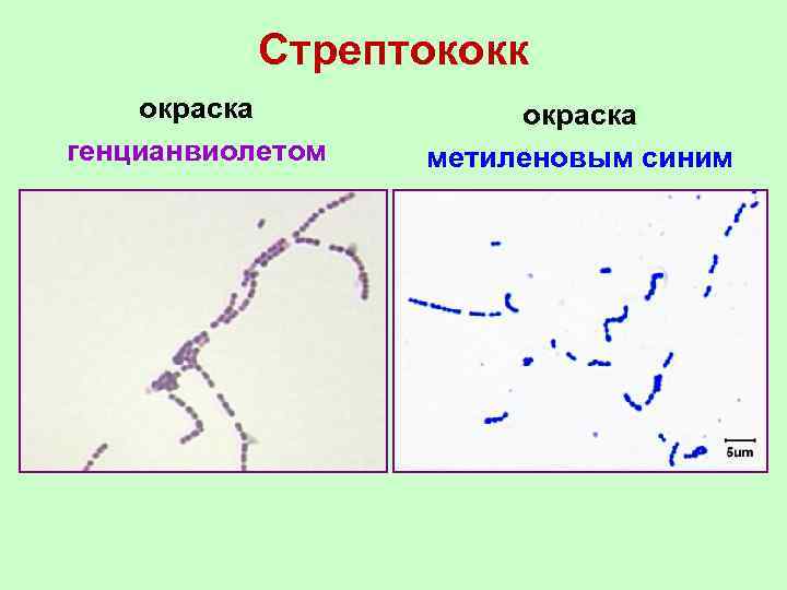 Стрептококк окраска генцианвиолетом окраска метиленовым синим 