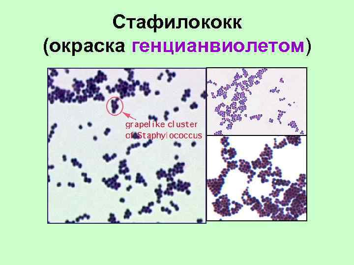 Стафилококк (окраска генцианвиолетом) 