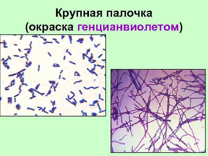 Крупная палочка (окраска генцианвиолетом) 