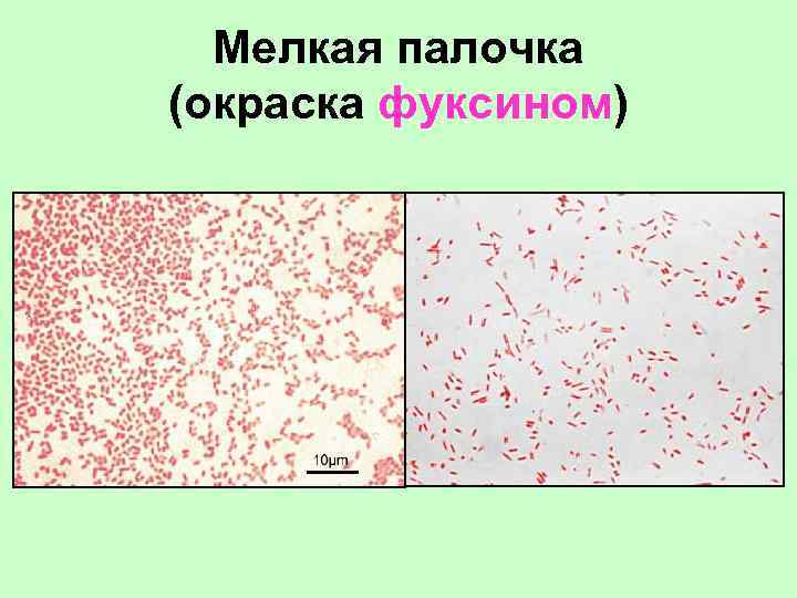 Мелкая палочка (окраска фуксином) 
