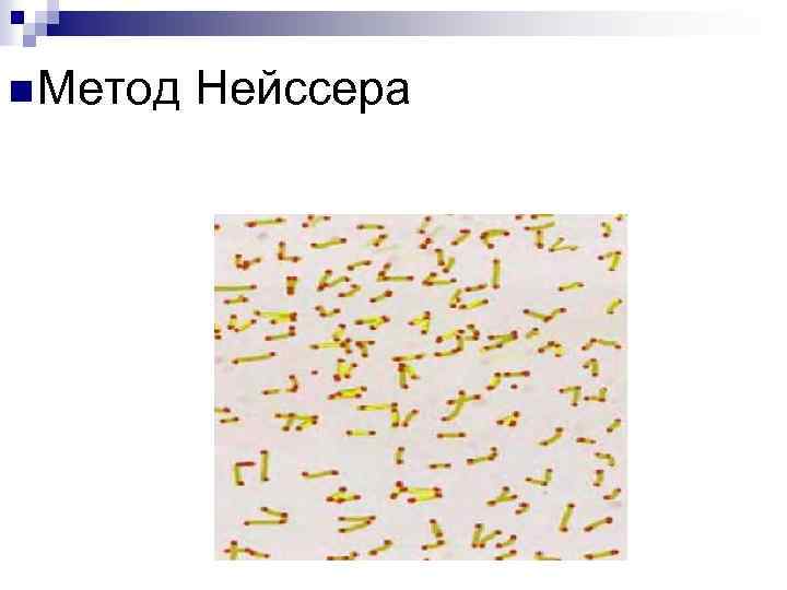 n Метод Нейссера 