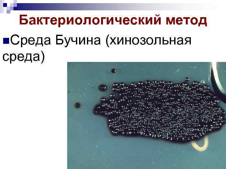 Бактериологический метод n. Среда Бучина (хинозольная среда) 