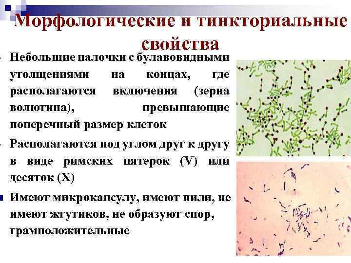 Морфологические и тинкториальные свойства Небольшие палочки с булавовидными утолщениями на концах, где располагаются включения