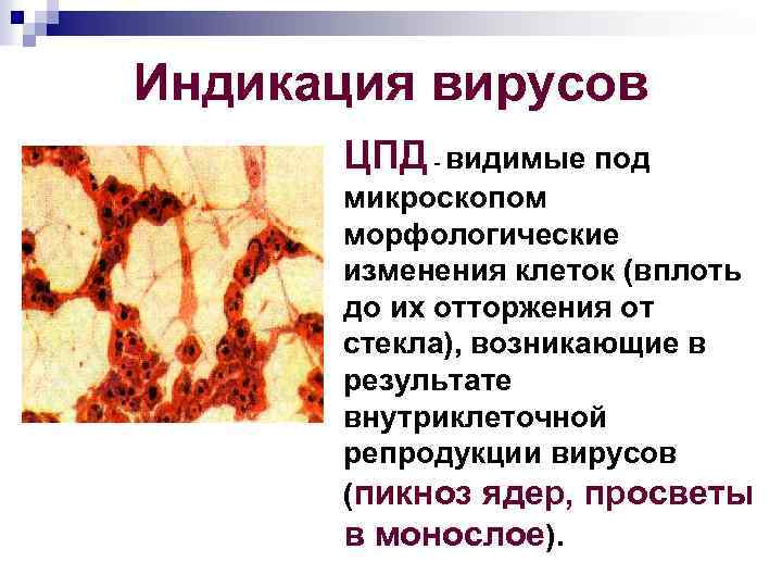 Индикация вирусов ЦПД видимые под микроскопом морфологические изменения клеток (вплоть до их отторжения от