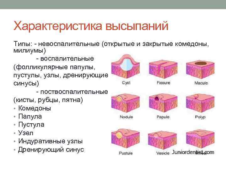 Виды кожных высыпаний таблица с картинками