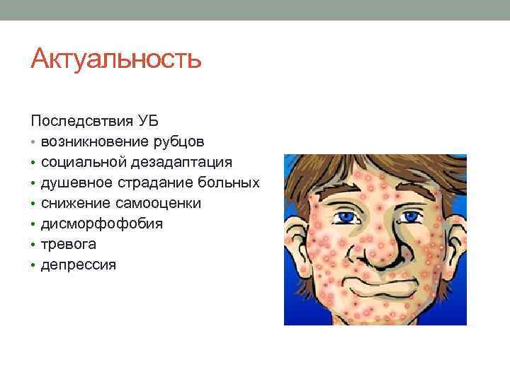 Актуальность Последсвтвия УБ • возникновение рубцов • социальной дезадаптация • душевное страдание больных •